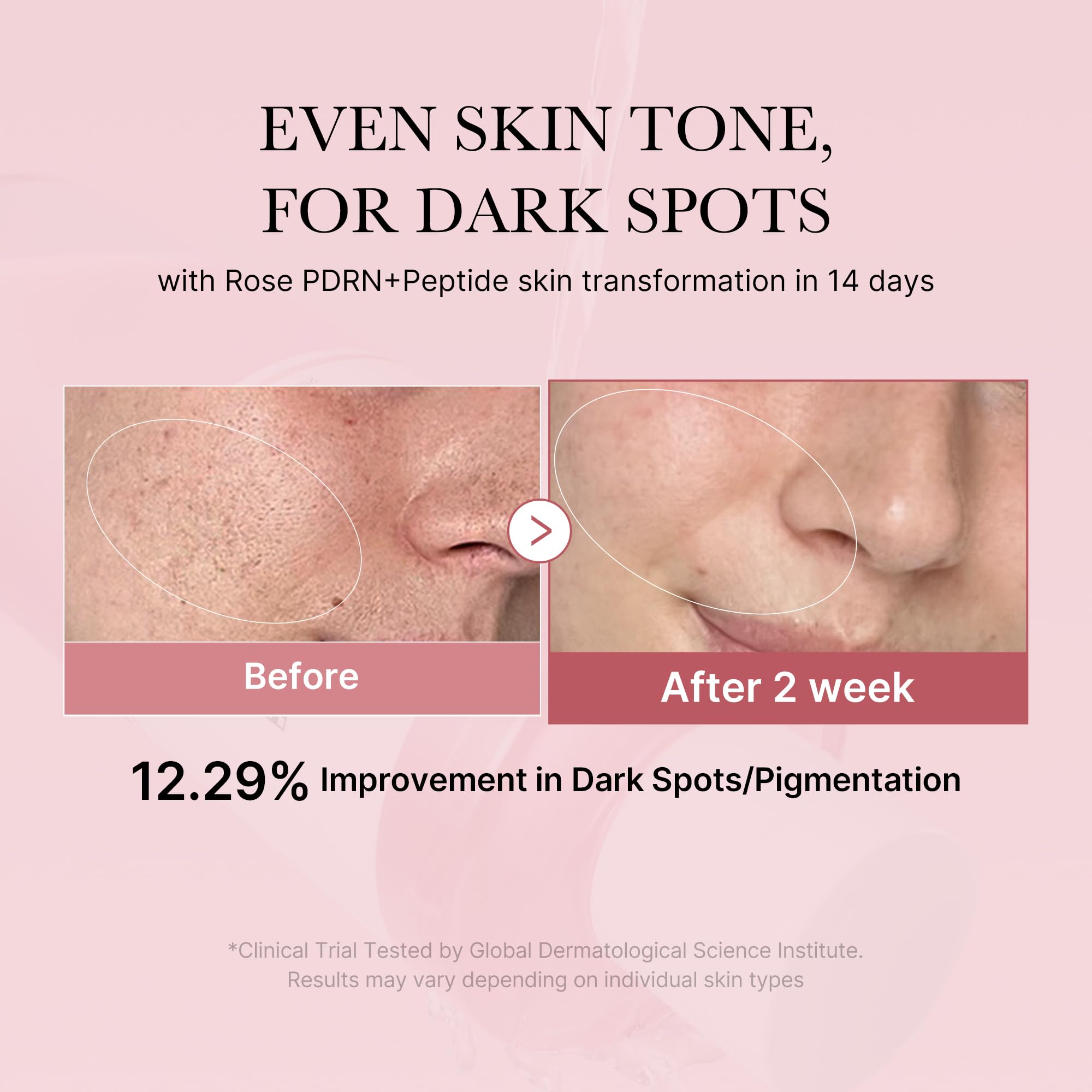 medicube PDRN Toner Salmon DNA Milky Toner | for Hydrating, Moisturizing, Soothing with Ceramide, Peptide | Glass Glow Skin | Korean Skincare, 5.07 fl.oz