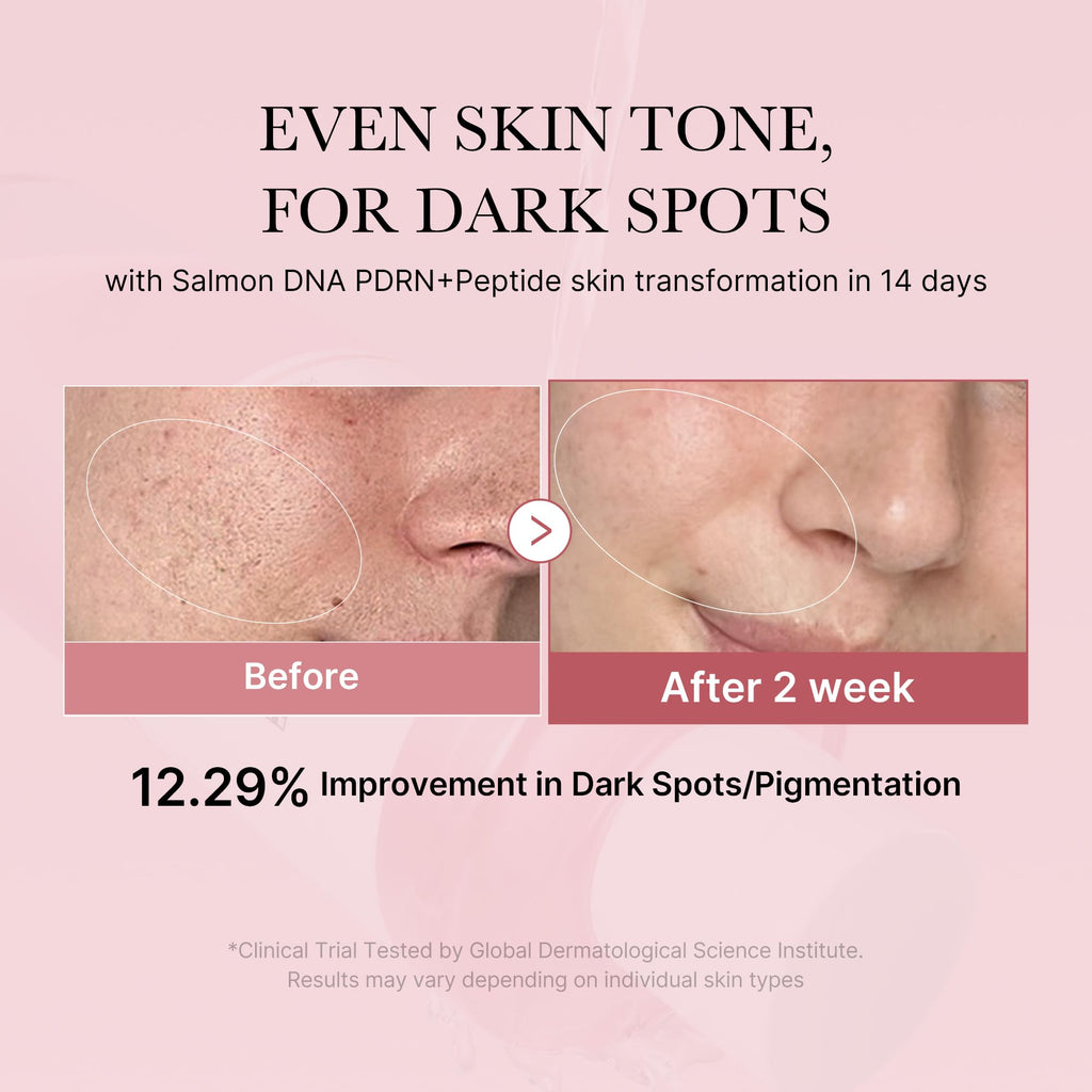medicube PDRN Toner Salmon DNA Milky Toner | for Hydrating, Moisturizing, Soothing with Ceramide, Peptide | Glass Glow Skin | Korean Skincare, 5.07 fl.oz