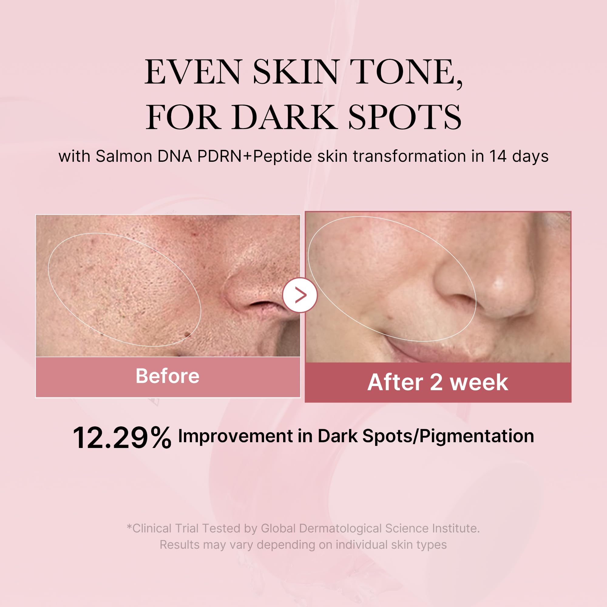 medicube PDRN Toner Salmon DNA Milky Toner | for Hydrating, Moisturizing, Soothing with Ceramide, Peptide | Glass Glow Skin | Korean Skincare, 5.07 fl.oz